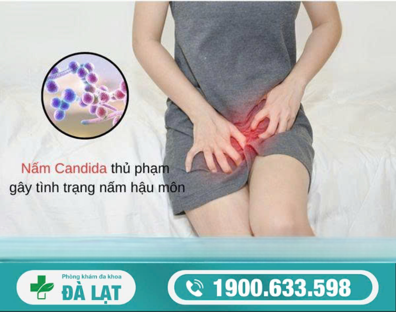 Hình ảnh minh họa